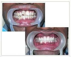 Slider image (6) All Smiles